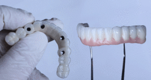 Dental Implant Model Showcasing Prosthetic Teeth on a Transparent Jaw for Educational.